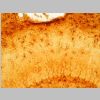 Astroglia GFAP 14.jpg